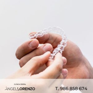 Angel Lorenzo_ortodoncia invisible